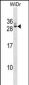 GTF2F2 Antibody (Center)